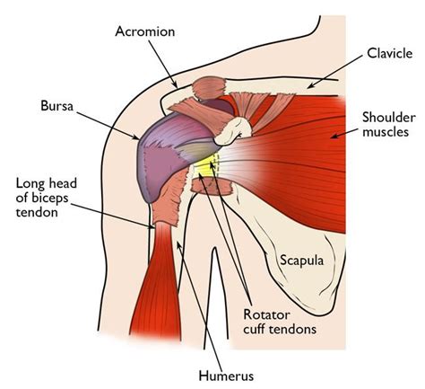 Shoulder Impingement/Rotator Cuff Tendinitis - OrthoInfo - AAOS