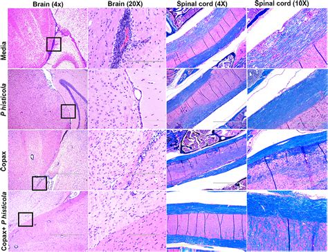 Frontiers | Prevotella histicola, A Human Gut Commensal, Is as Potent ...