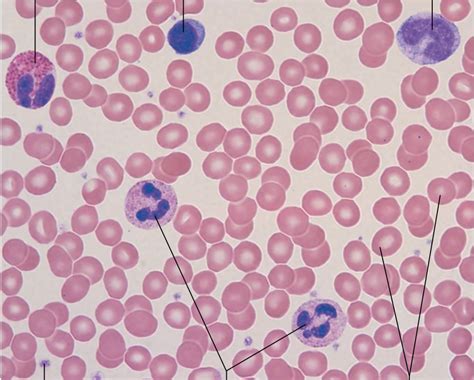 human blood smear stained with wright's stain Diagram | Quizlet