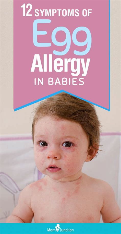 12 Symptoms Of Egg Allergy In Babies And Their Treatment | Egg allergy, Egg allergy baby, Allergies