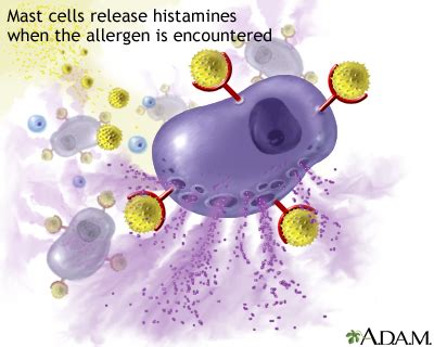 Histamine is released: MedlinePlus Medical Encyclopedia Image