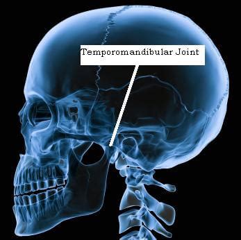 TMJ x-rays | News | Dentagama