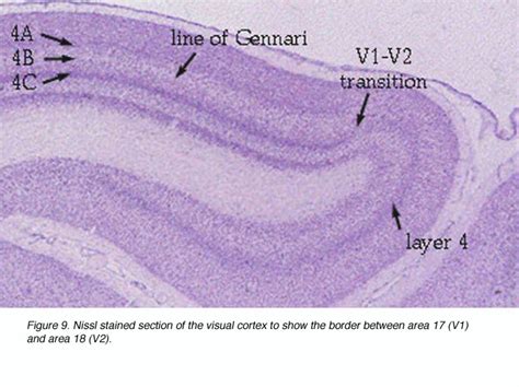 GLAUCOMA SPECIALIST BLOG: "THE GLOG": VISUAL CORTEX