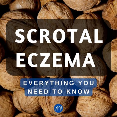 Scrotal Eczema: Everything You Need to Know