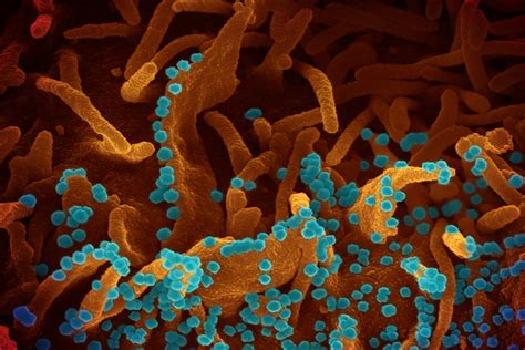 Lactococcus Ferment Lysate Explained, Skin Benefits, INCI - Procoal