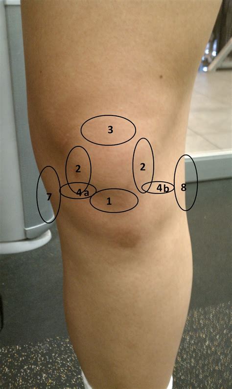 Dr. David Kwon's Blog: Ouch! My Knee Hurts!!! [Part 1]