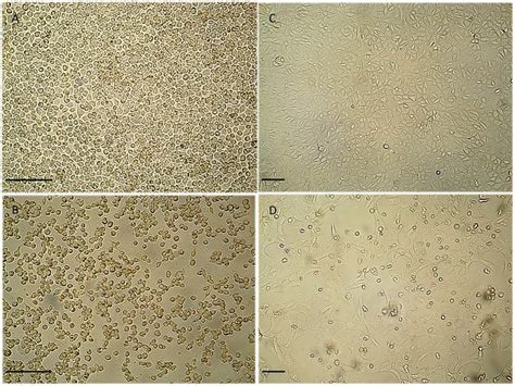 Cytopathic effect in infected and uninfected cell cultures. Cytopathic ...