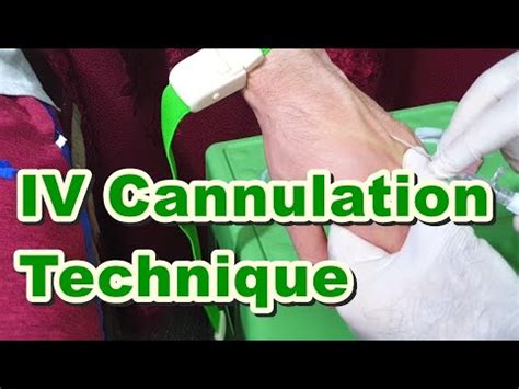 How to Insert IV Cannula | IV Cannulation Technique | Branula | Intravenous Catheter - YouTube