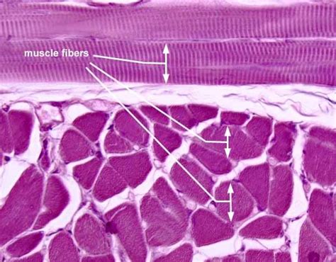 anatomyforme: Muscle Tissue Histology