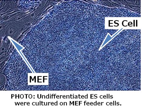 MEF Feeder Cells - Feeder Cells from REPROCELL USA Inc. UK