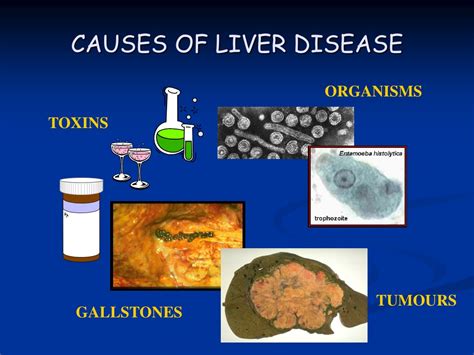 PPT - LIVER PowerPoint Presentation, free download - ID:9355760