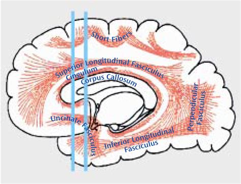 Uncinate Fasciculus Anatomy