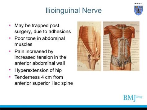 Anatomy of nerve_injuries_lower_limb