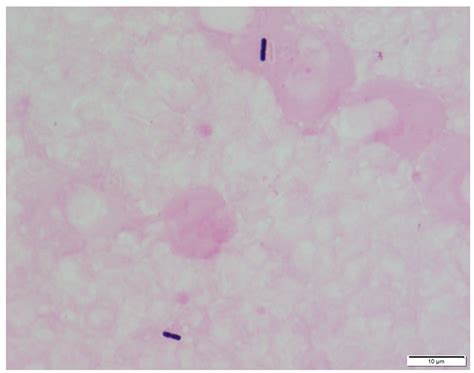 Clostridium Perfringens Gram Stain