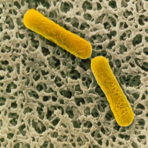 Clostridium Botulinum Bacteria Photograph by Cnri - Pixels