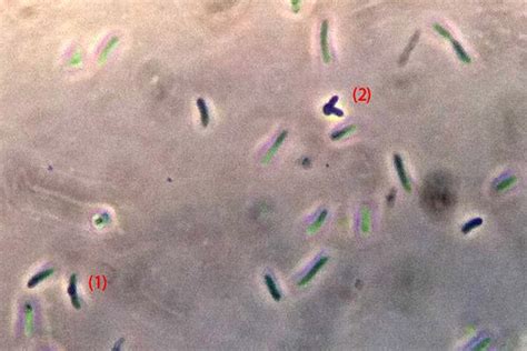 Proteus Mirabilis Cell Morphology