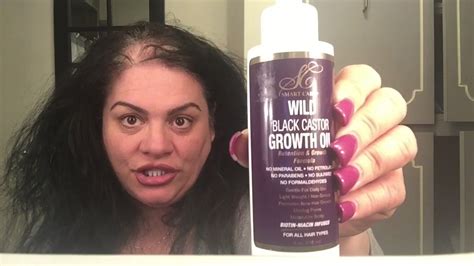 Wild Hair Growth Oil Before And After