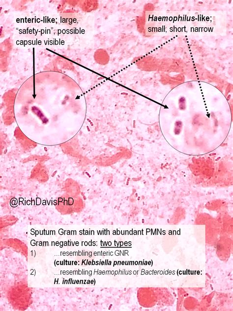 Haemophilus Influenzae Gram Stain - Pin By Nancy De Jesus Torres On Bio Microbiology Medical ...