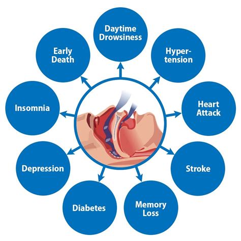 Wearing a collar to resolve Obstructive Sleep Apnea... : SleepApnea