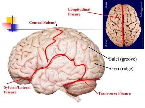 Transverse Fissure Brain