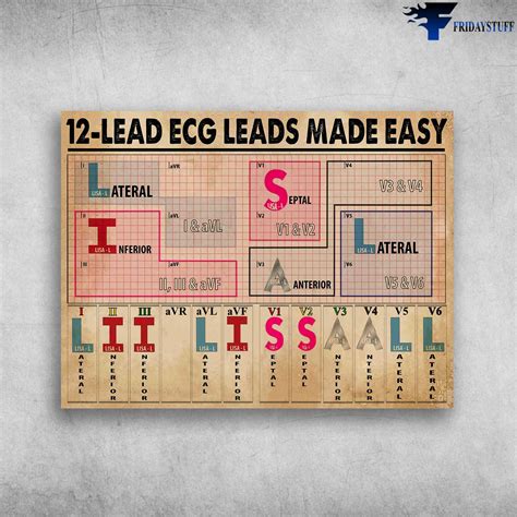 12-Lead Ecg Leads Made Easy, Lateral, Septal, Inferior, Anterior - FridayStuff