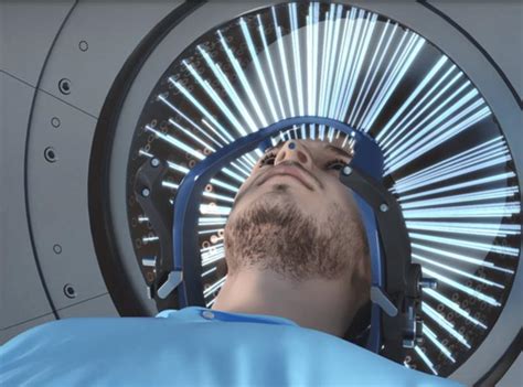 Gamma Knife Market Expecting Huge Demand in Upcoming Years