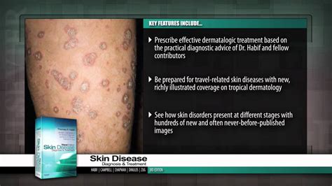 Skin Disease: Diagnosis and Treatment, 3rd Edition - YouTube