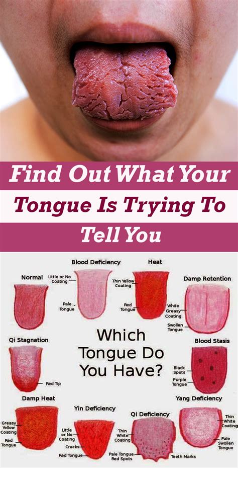 What Is Your Tongue Telling You About Your Health? | Healthy Wellness 101