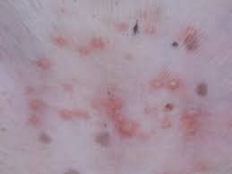 Dog Rash on Belly: Causes, Pictures, and Treatment of Rash on Dog’s ...