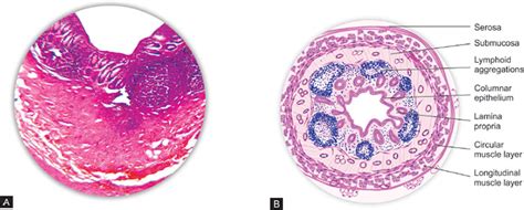 Vermiform Appendix Histology