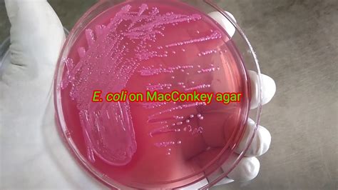 E. coli on MacConkey agar, blood agar and Chocolate agar - YouTube