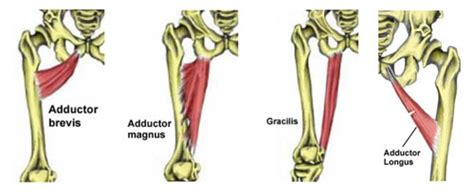 Hip Groin Muscle Anatomy Groin Inflammation Adductor Tendinopathy ...