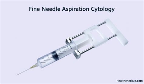 Fine Needle Aspiration Cytology: Preparation, Procedure, Results