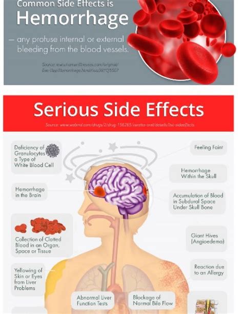 What are the side effects of xarelto