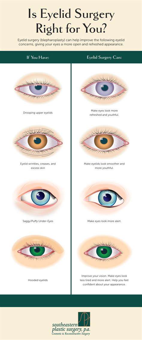 What Is the Best Treatment for Hooded Eyelids & Other Eyelid Issues? (Infographic ...