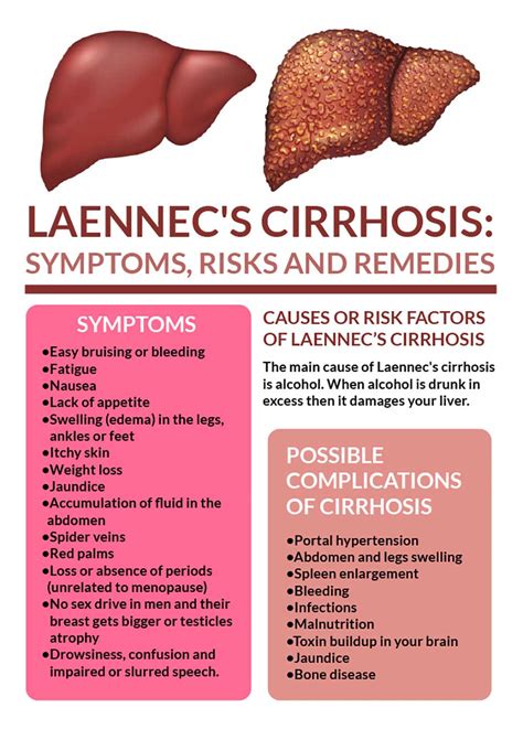 Laennec's Cirrhosis: Signs, Risks, and Remedies - Fatty Liver Disease