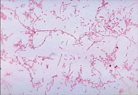 Enterobacter Gram Stain Results