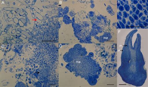 Protein staining with Coomassie brilliant blue R-250 (CBB) in ...