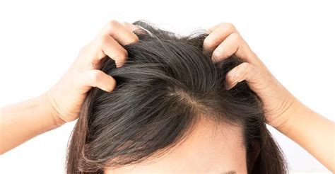 Scalp Pain Causes And Treatment Options - FACE Medical Supply