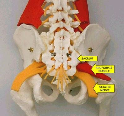 Piriformis Syndrome Treatment in Greenville, SC | SI Joint Pain Treatment in Spartanburg and ...