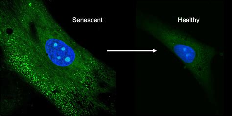 New drug delivery method can reverse senescence of stem cells | Carl R ...