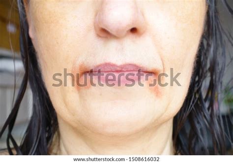 1 Rhagaden Images, Stock Photos & Vectors | Shutterstock