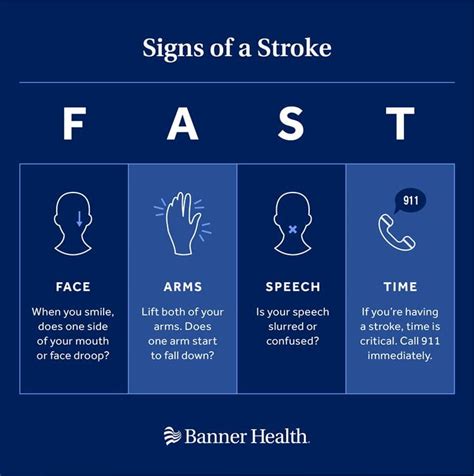 Stroke Symptoms Face