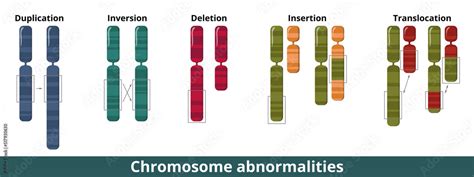 Chromosome abnormalities. Visualization of common chromosomal mutation ...