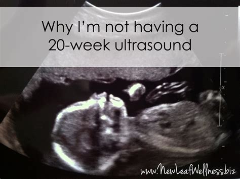 Why I’m skipping the 20-week ultrasound – The Family Freezer