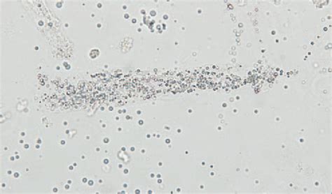 Urinalysis in Companion Animals: Urine Chemistry & Sediment