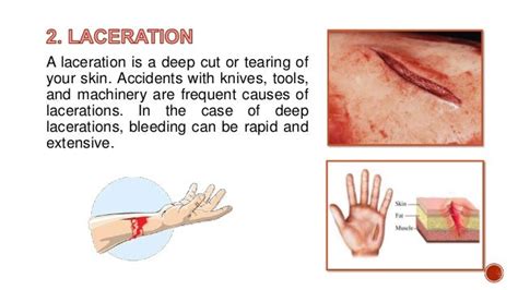 Dressing Surgical Wounds, Abrasion and Lacerations