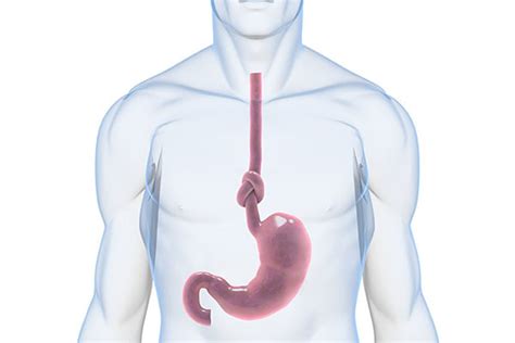 Symptoms of Gastrointestinal Disorders