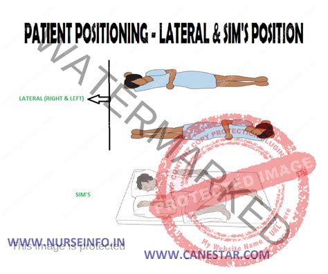 PATIENT POSITIONING – LATERAL & SIM’S POSITION - Nurse Info PATIENT ...