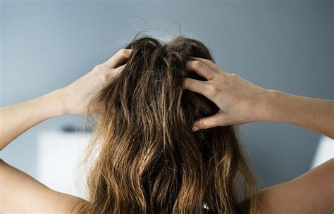 Scalp Buildup: Causes, Treatment, And Prevention